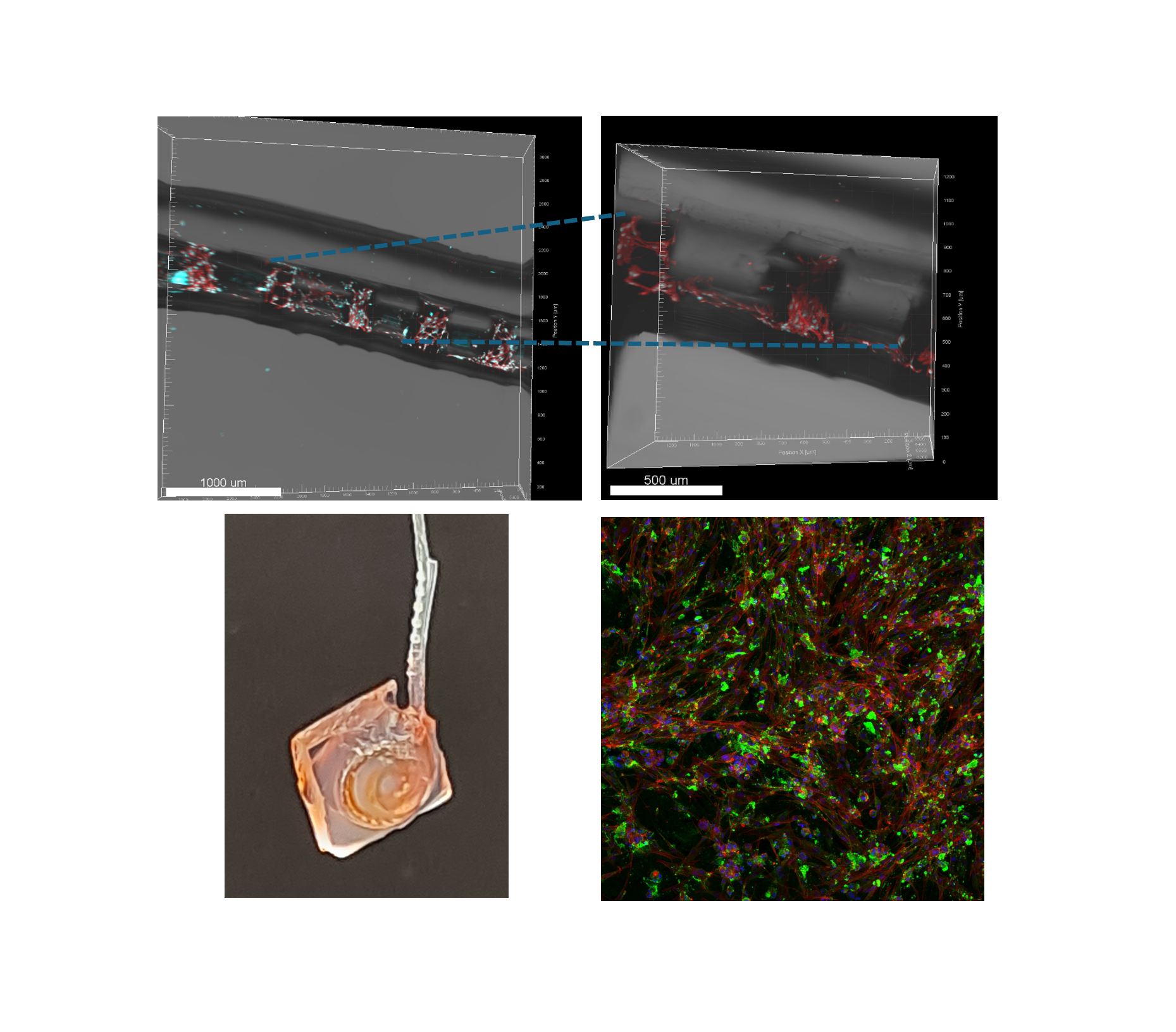 Engineering Fibrosis