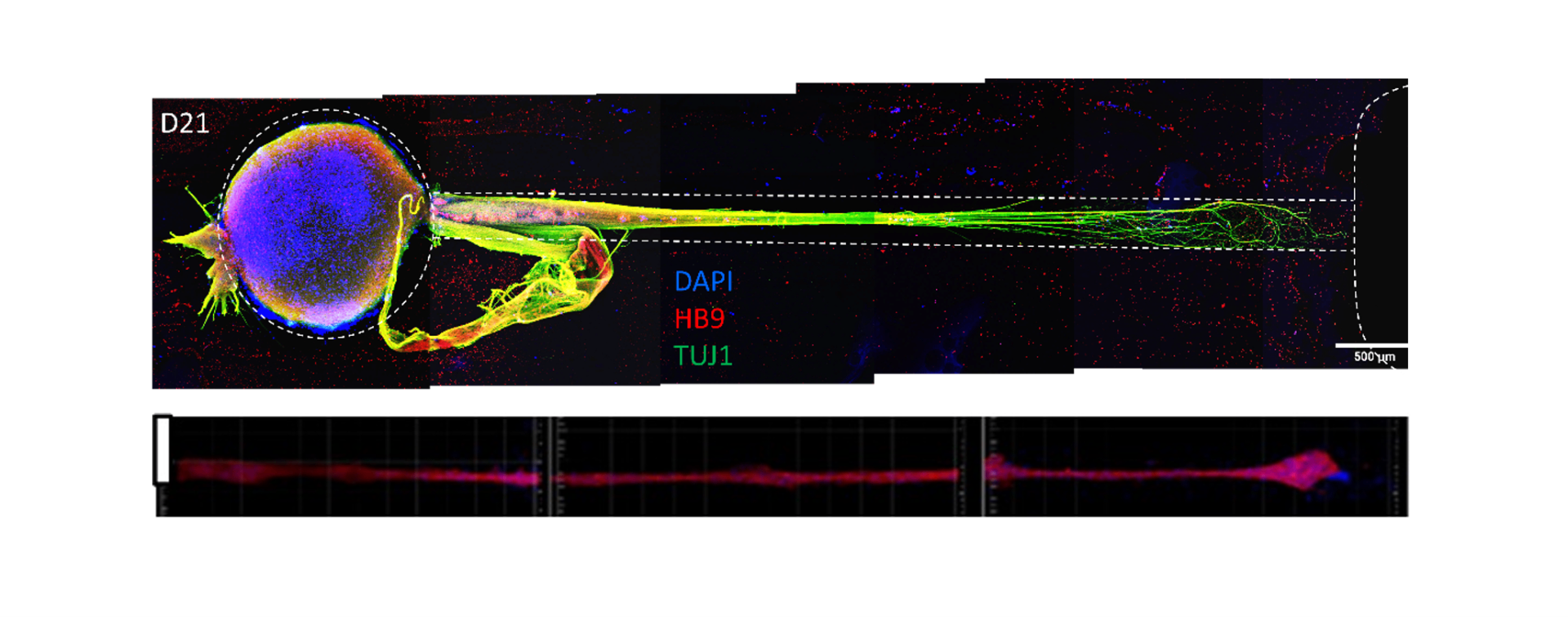 Nerve Tissue Engineering