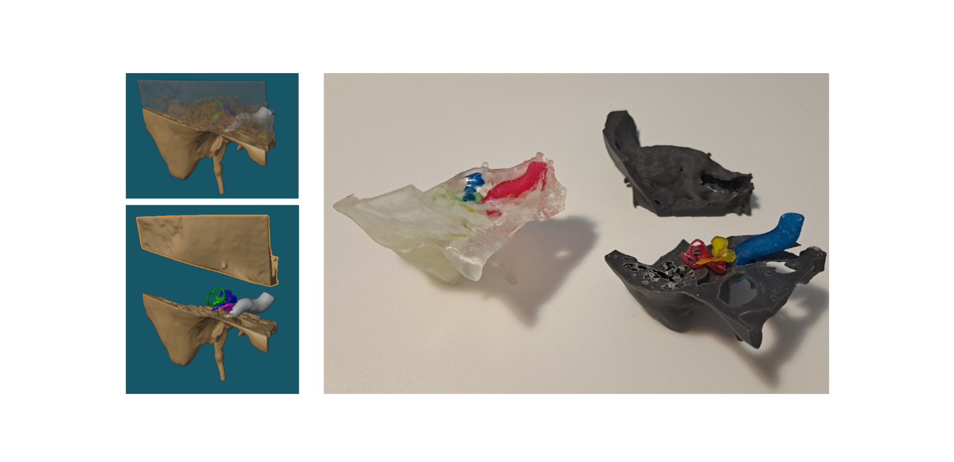 Temporal Bone Models
